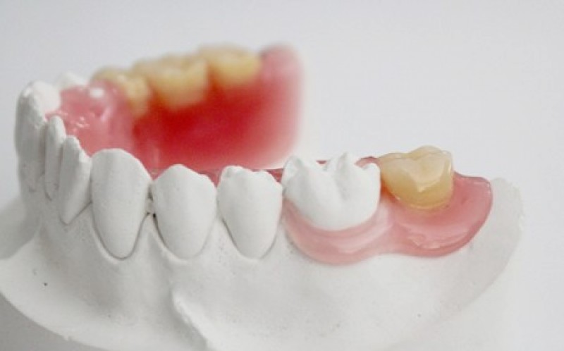 THÁO LẮP DẺO BÁN HÀM